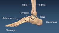 High Impact Ankle Dislocation & Fracture