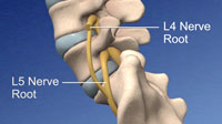 Lumbar Levels