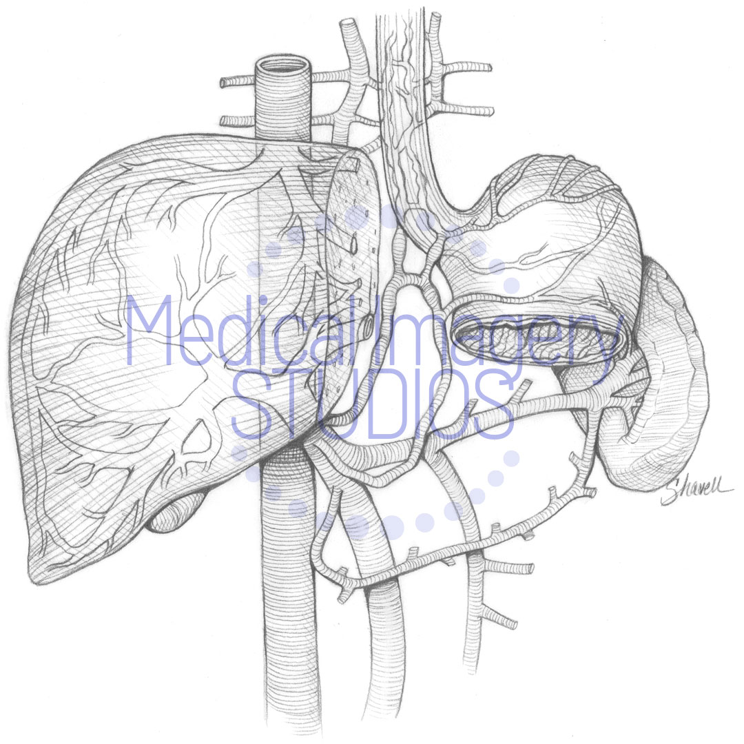 Liver, Esophagus, Stomach and Spleen