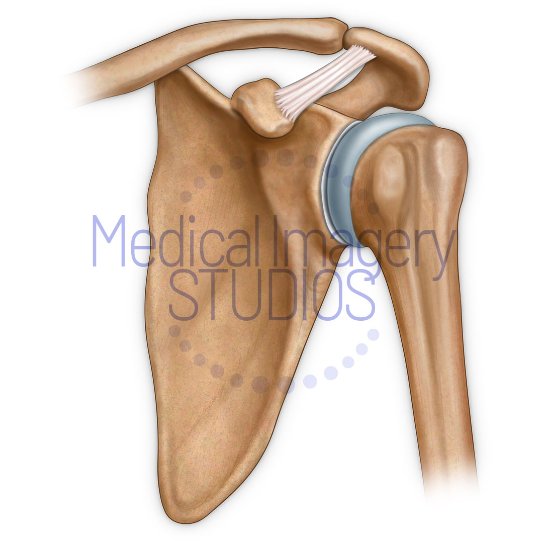 Shoulder Bones