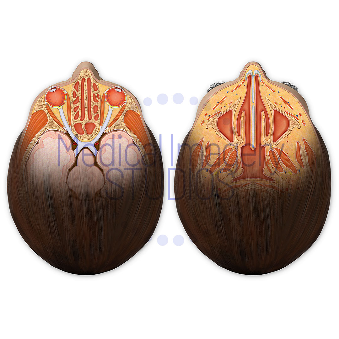 Sinuses Axial View Anatomy
