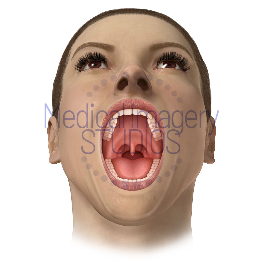 Open Mouth View of Tonsils