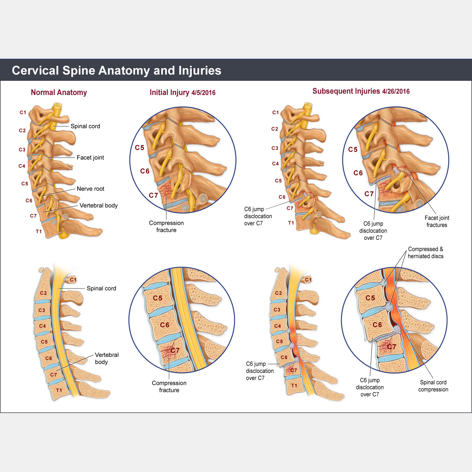 Cervical Spine Anatomy