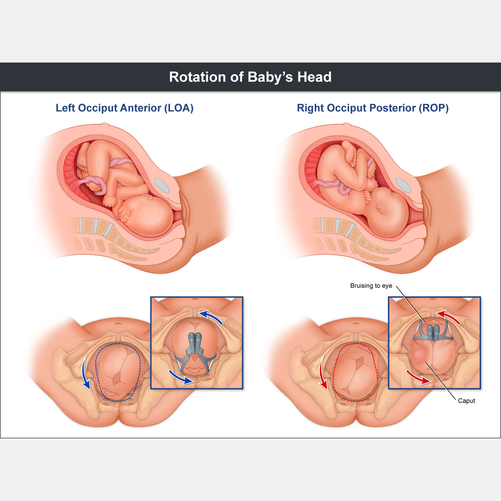 Rotation of Babys Head
