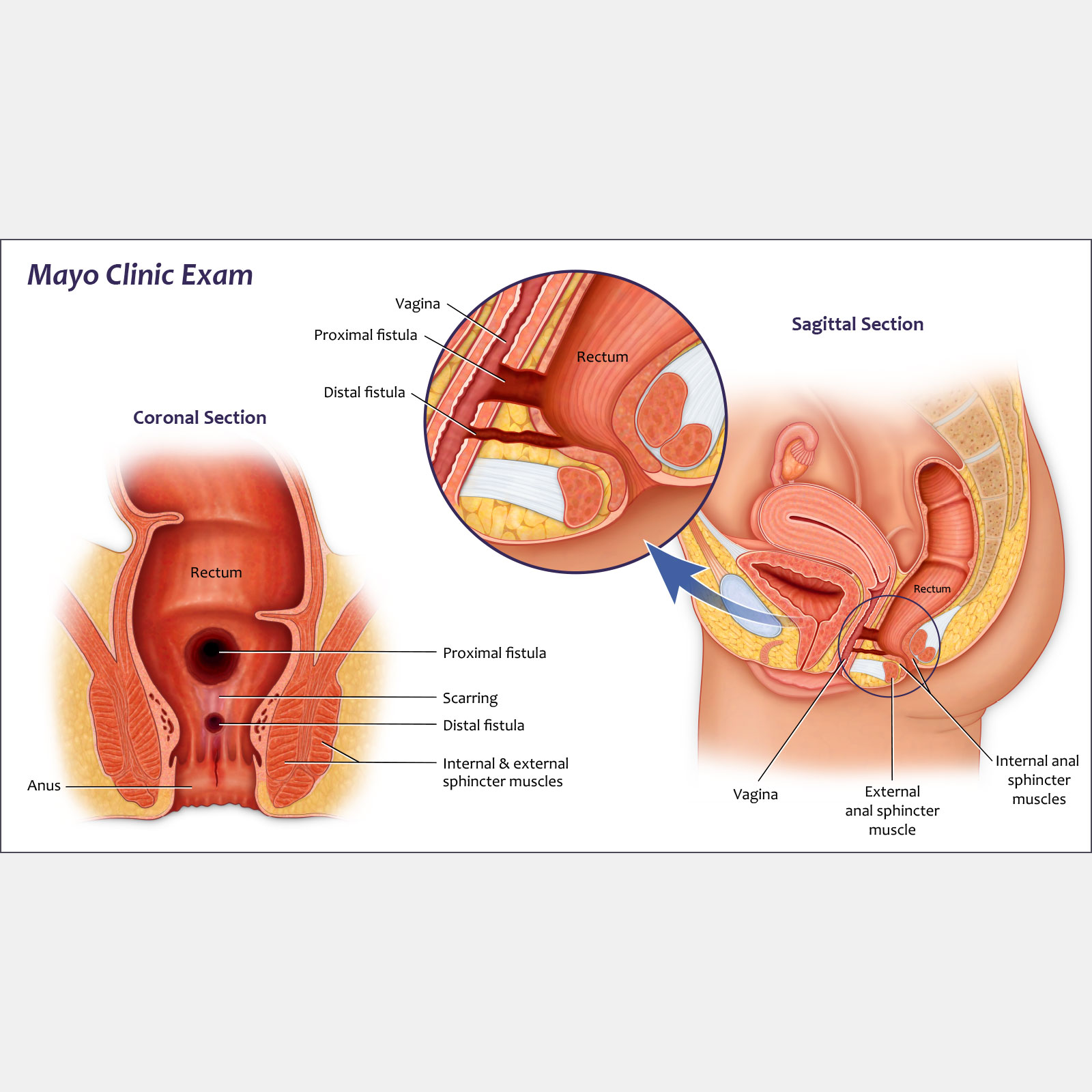 Clinic Exam