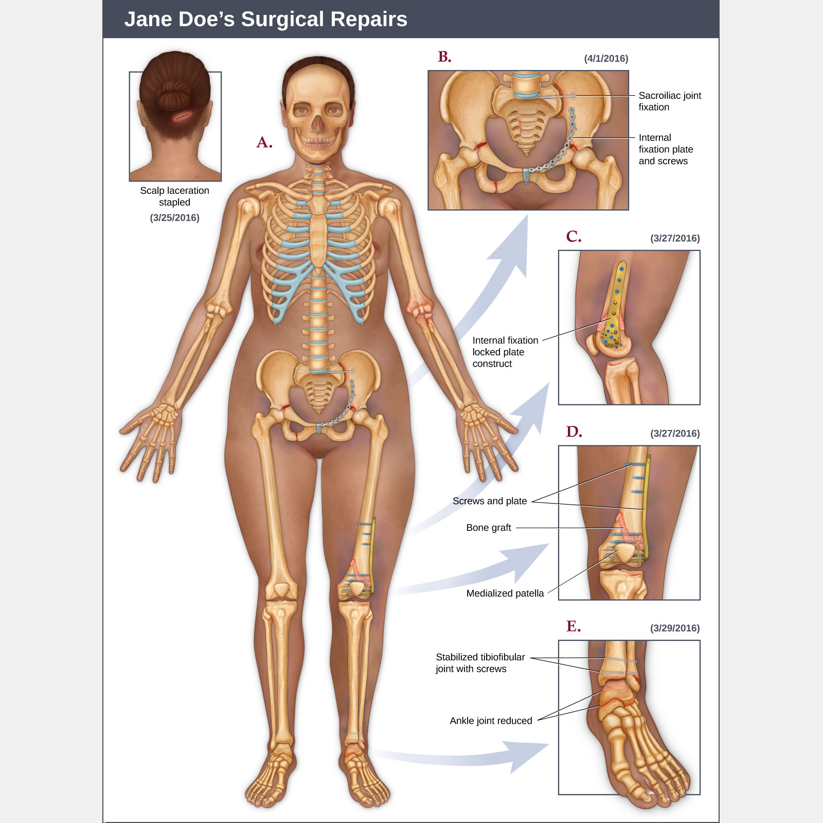 Surgical Repairs