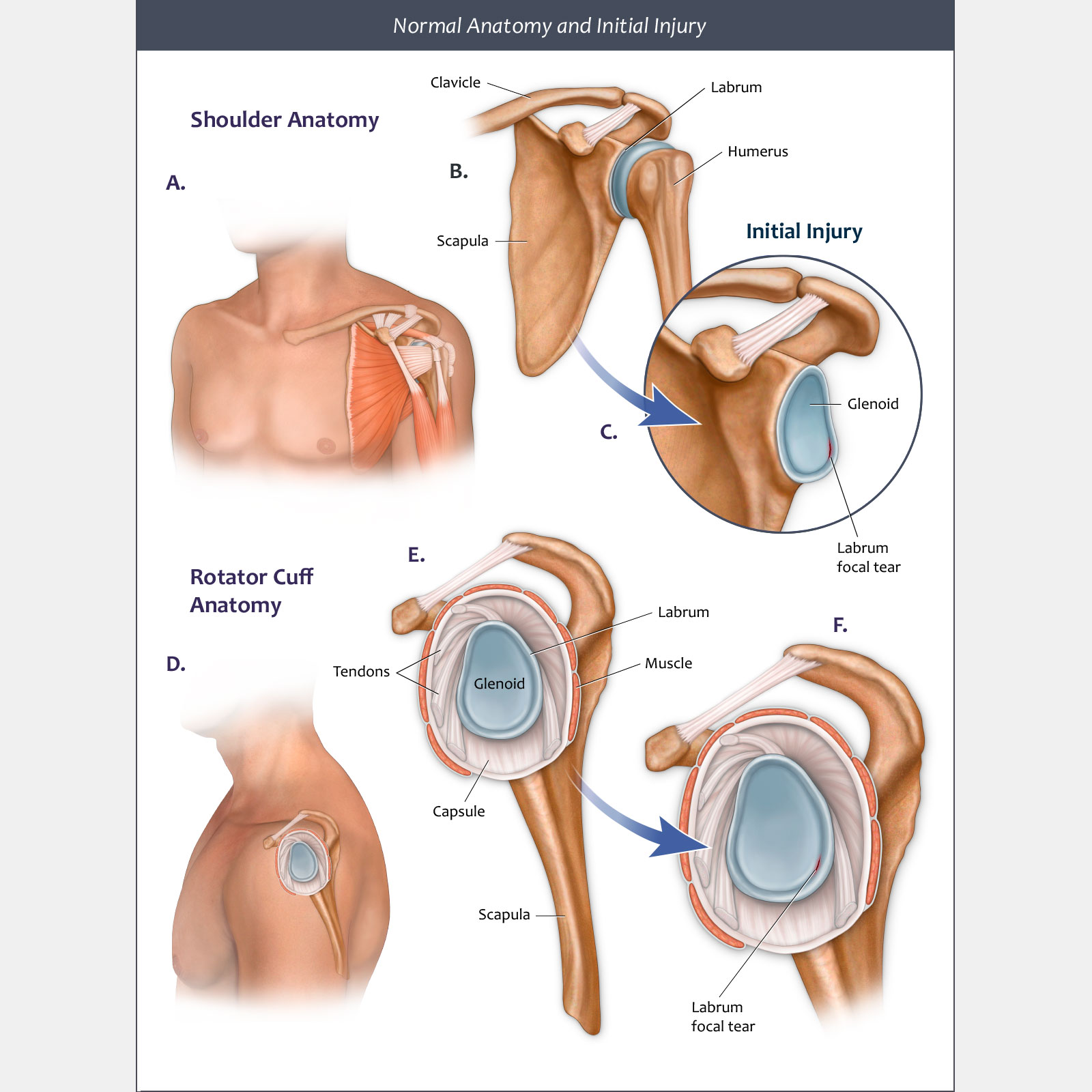 Normal Anatomy & Initial Injury