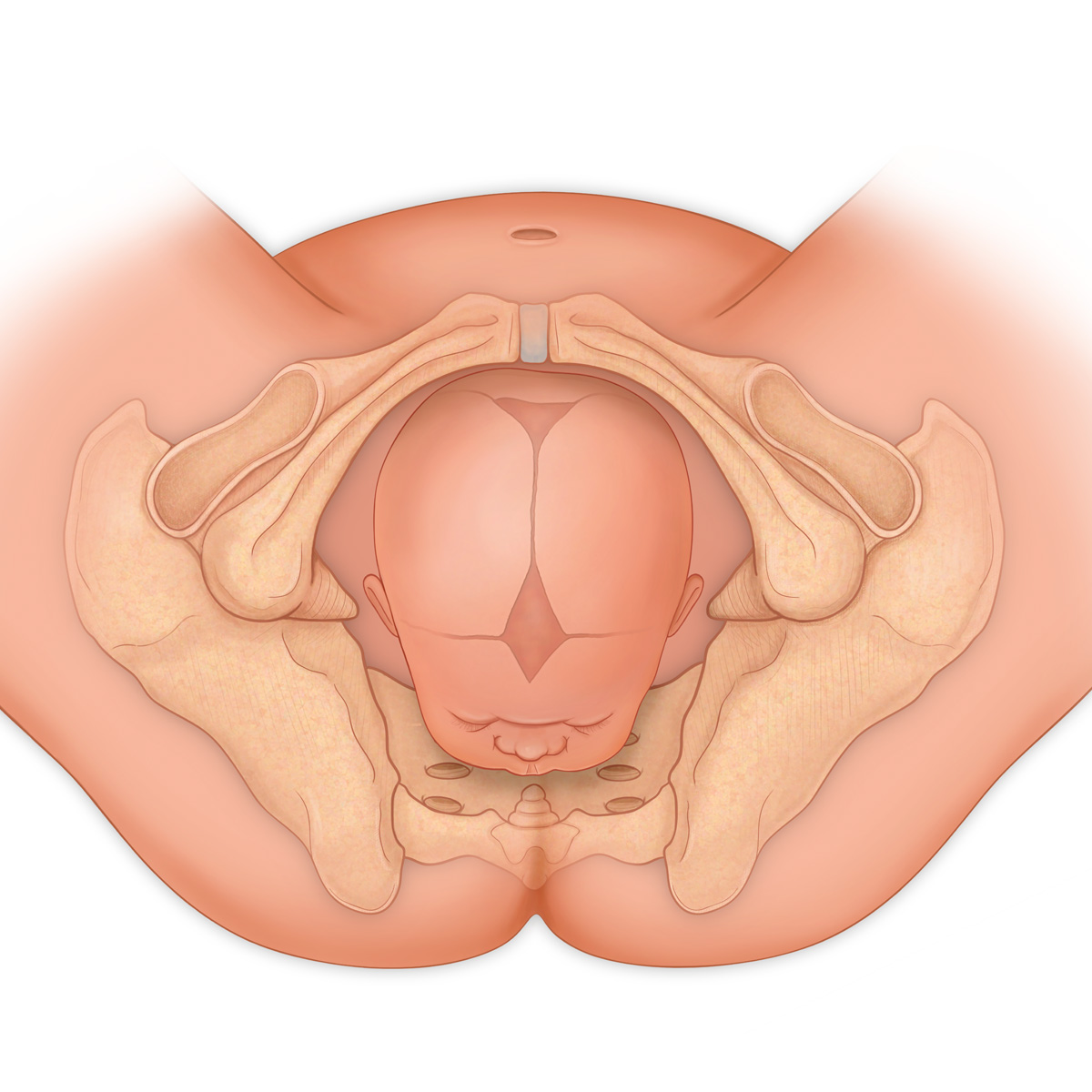 Occiput Anterior Delivery