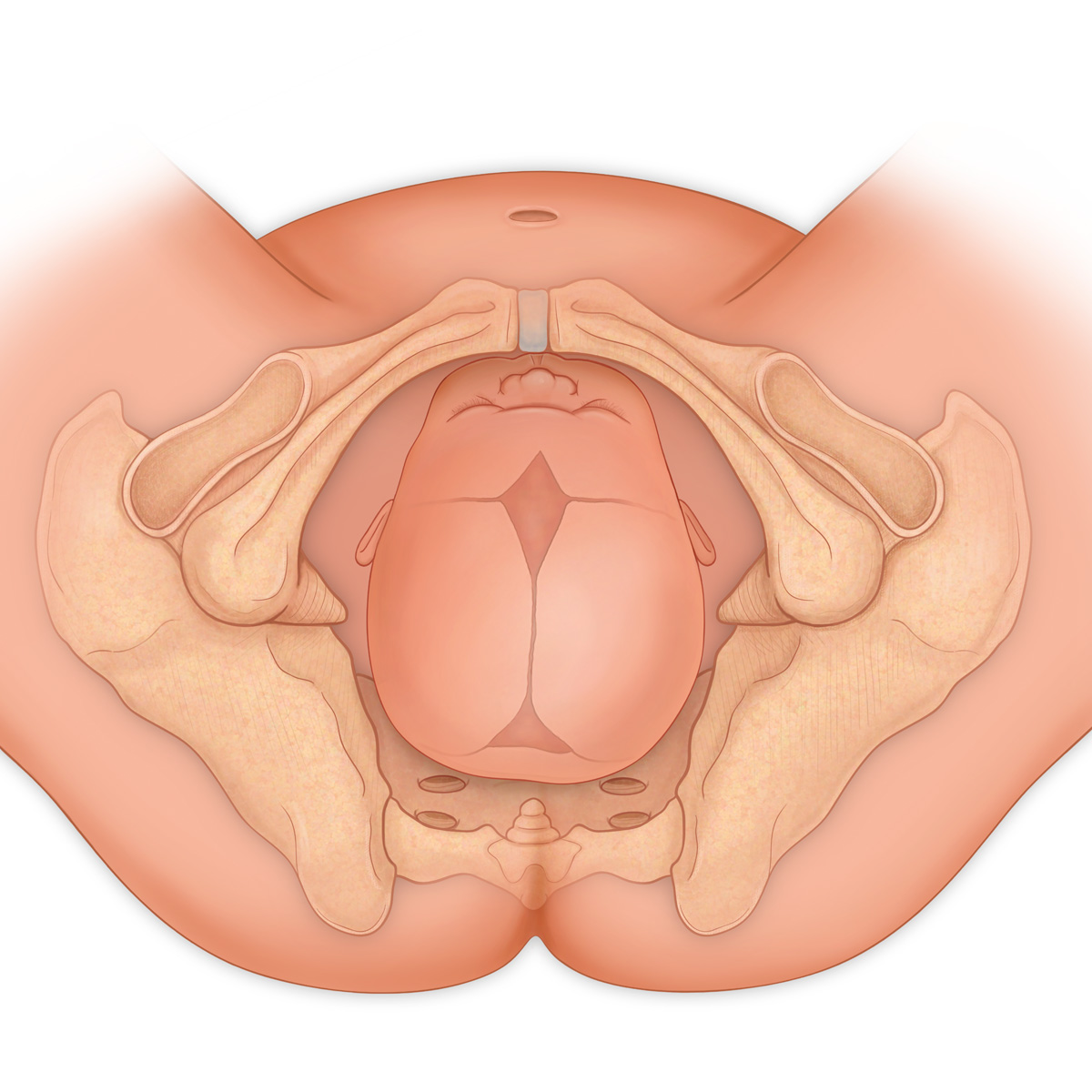 Occiput Anterior Delivery