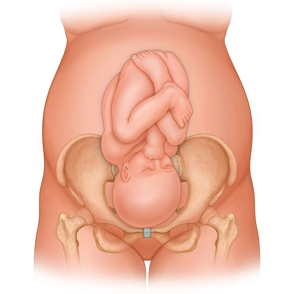 Right Occiput Anterior Presentation