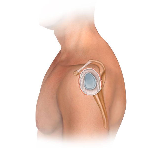 Side View Body with Rotator Cuff Anatomy