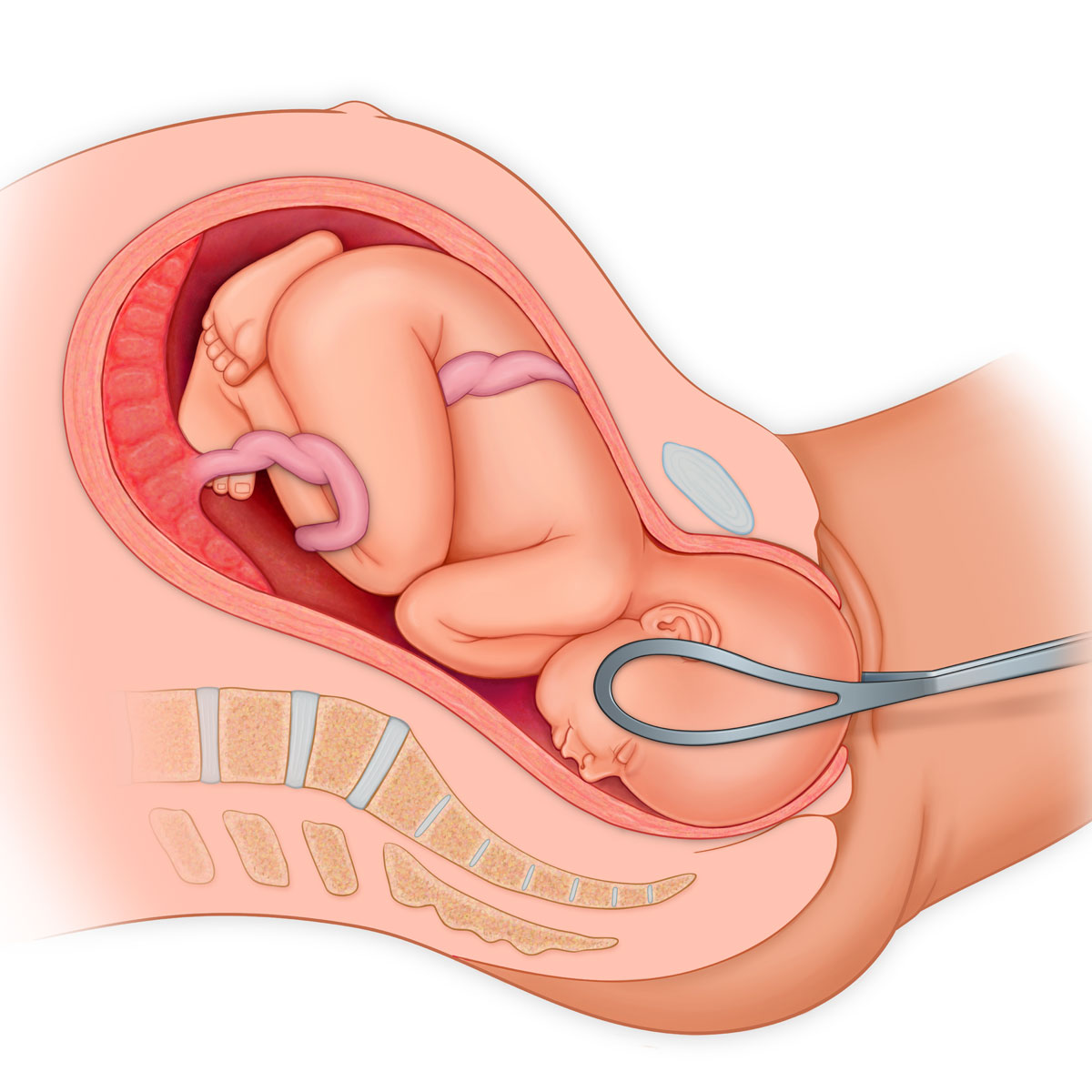 Left Occiput Anterior Presentation