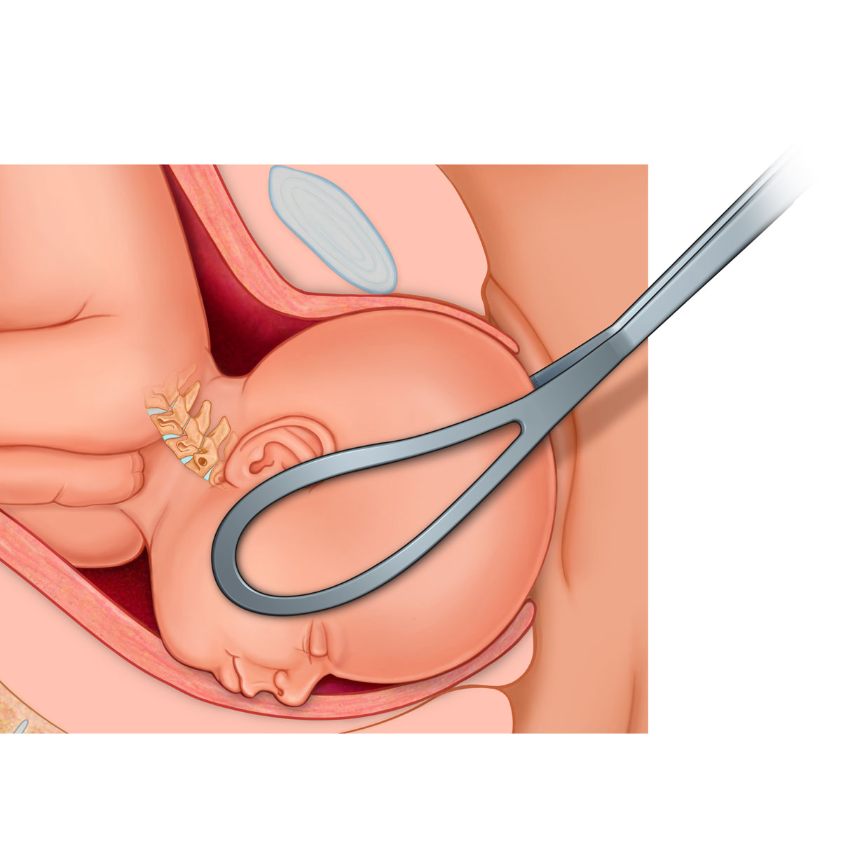 Left Occiput Anterior Presentation