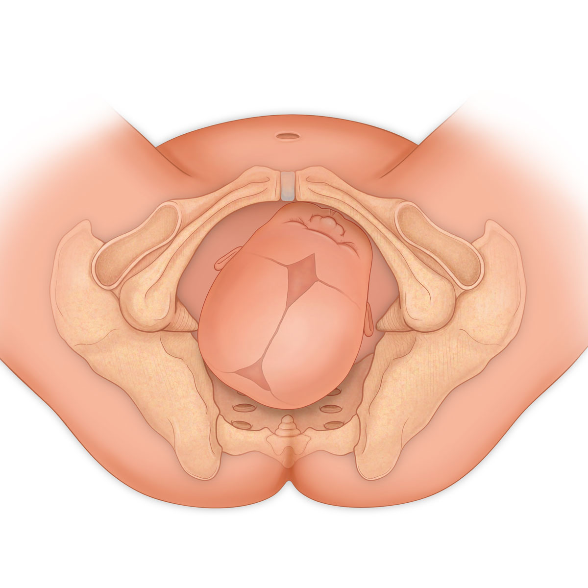 Right Occiput Posterior Presentation