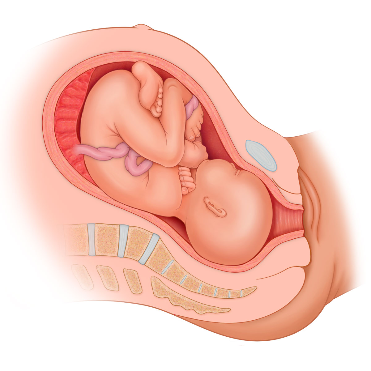 Right Occiput Anterior Presentation
