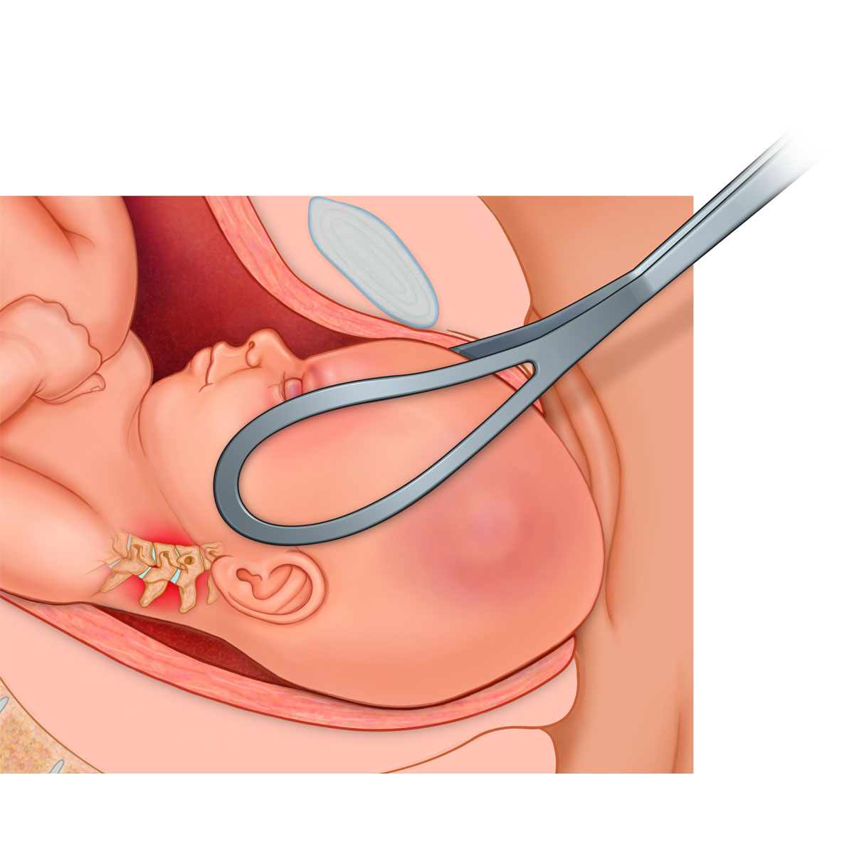 Right Occiput Anterior Presentation