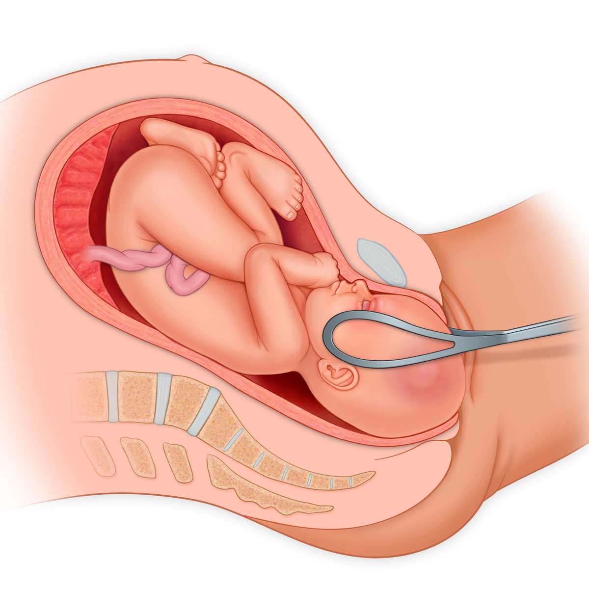 Right Occiput Anterior Presentation